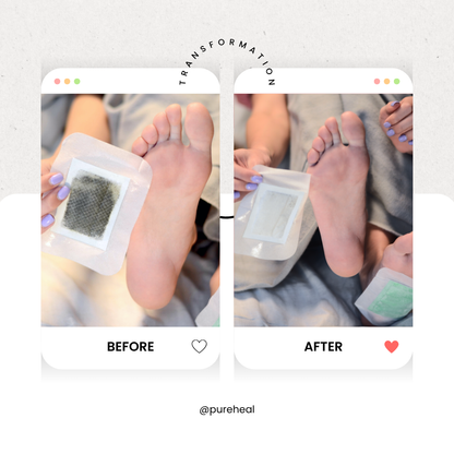 Detox Foot Patches